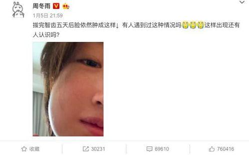 吃瓜爆料李现谭松韵,吃瓜群众热议恋情真相